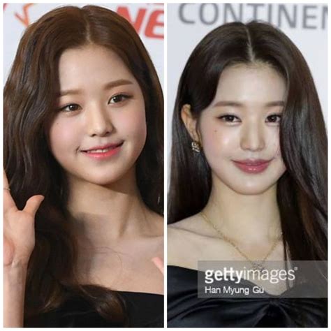 The Truth about Wonyoung's Lip Filler: Debunking Fake Rumors.